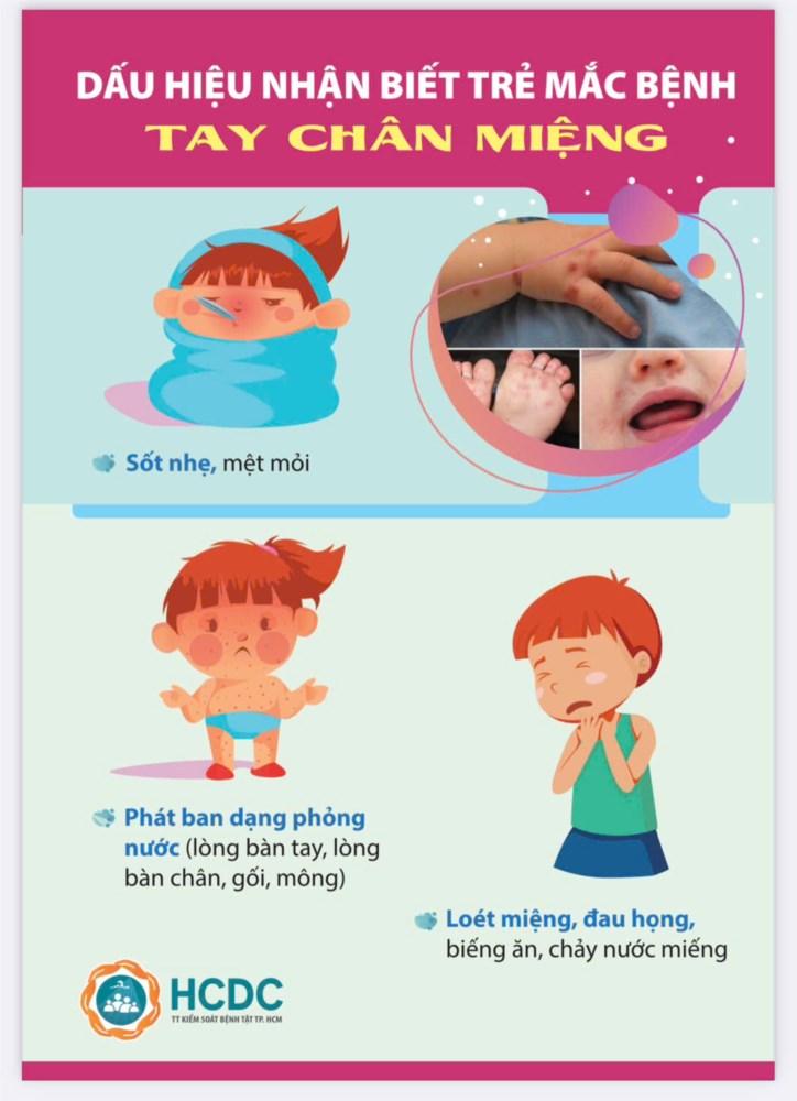 Các dấu hiệu nhận biết bệnh Tay Chân Miệng.