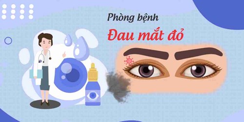 Khuyến cáo phòng, chống đau mắt đỏ