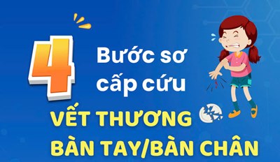 4 bước sơ cấp cứu vết thương bàn tay, bàn chân