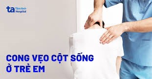 Làm sao để phát hiện vẹo cột sống ở trẻ sớm nhất?