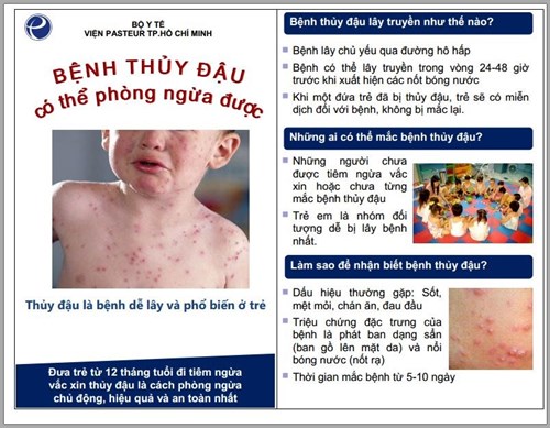 [THCS Phan Bội Châu] Truyền thông về bệnh Thủy đậu năm học 2024 - 2025